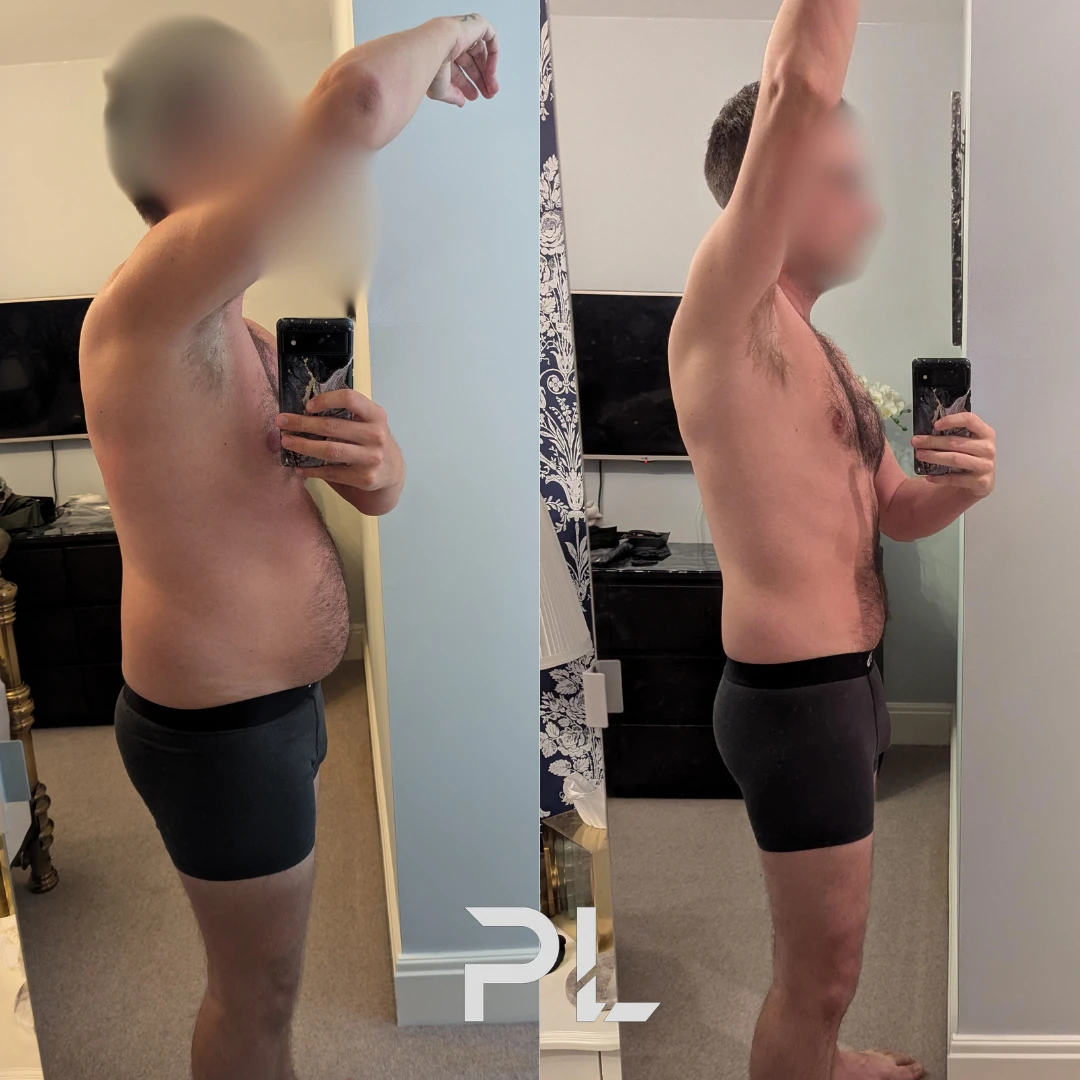 Client before and after: side view, flatter stomach