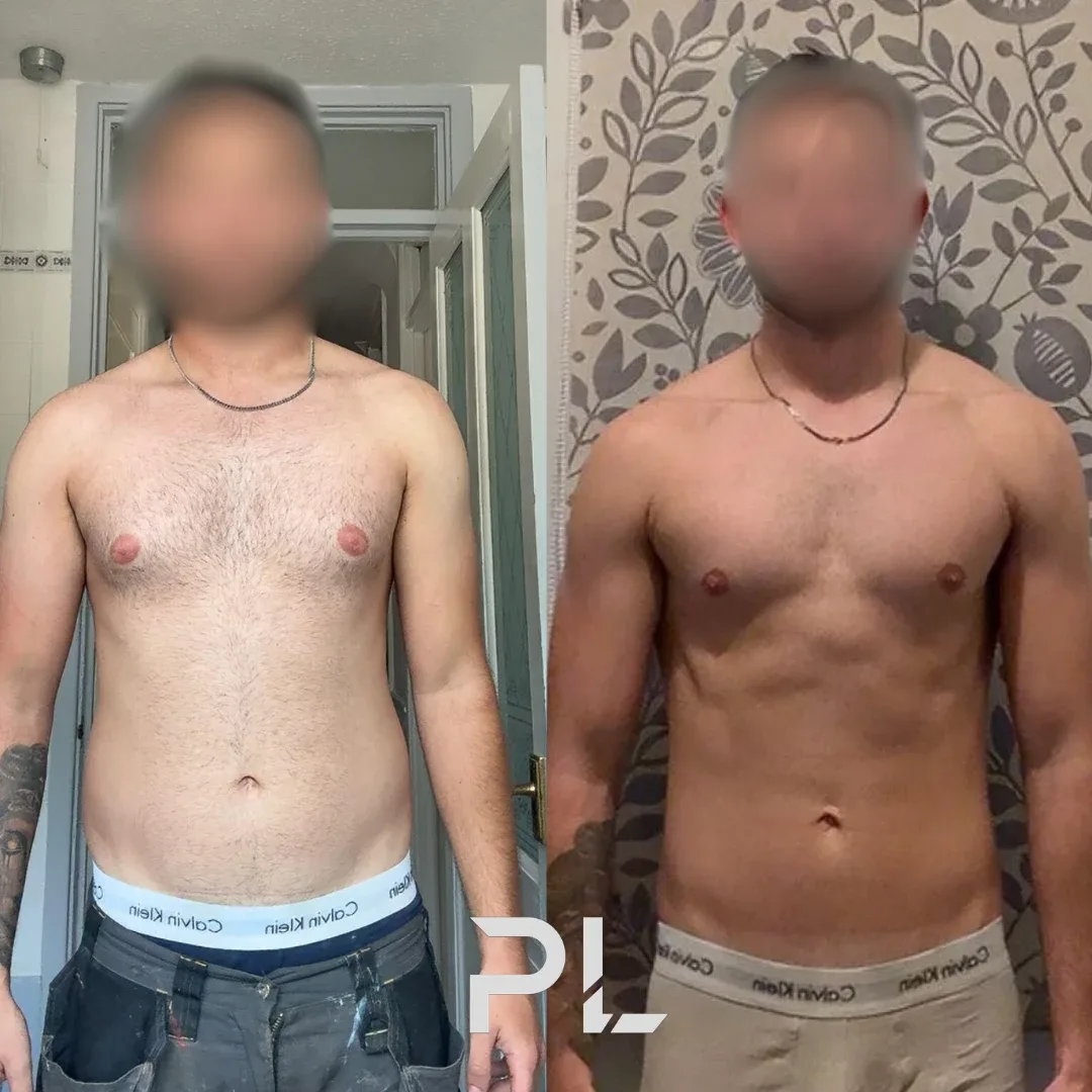 Client before and after: front view, leaner with visible abs